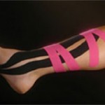 Kinesio Tape